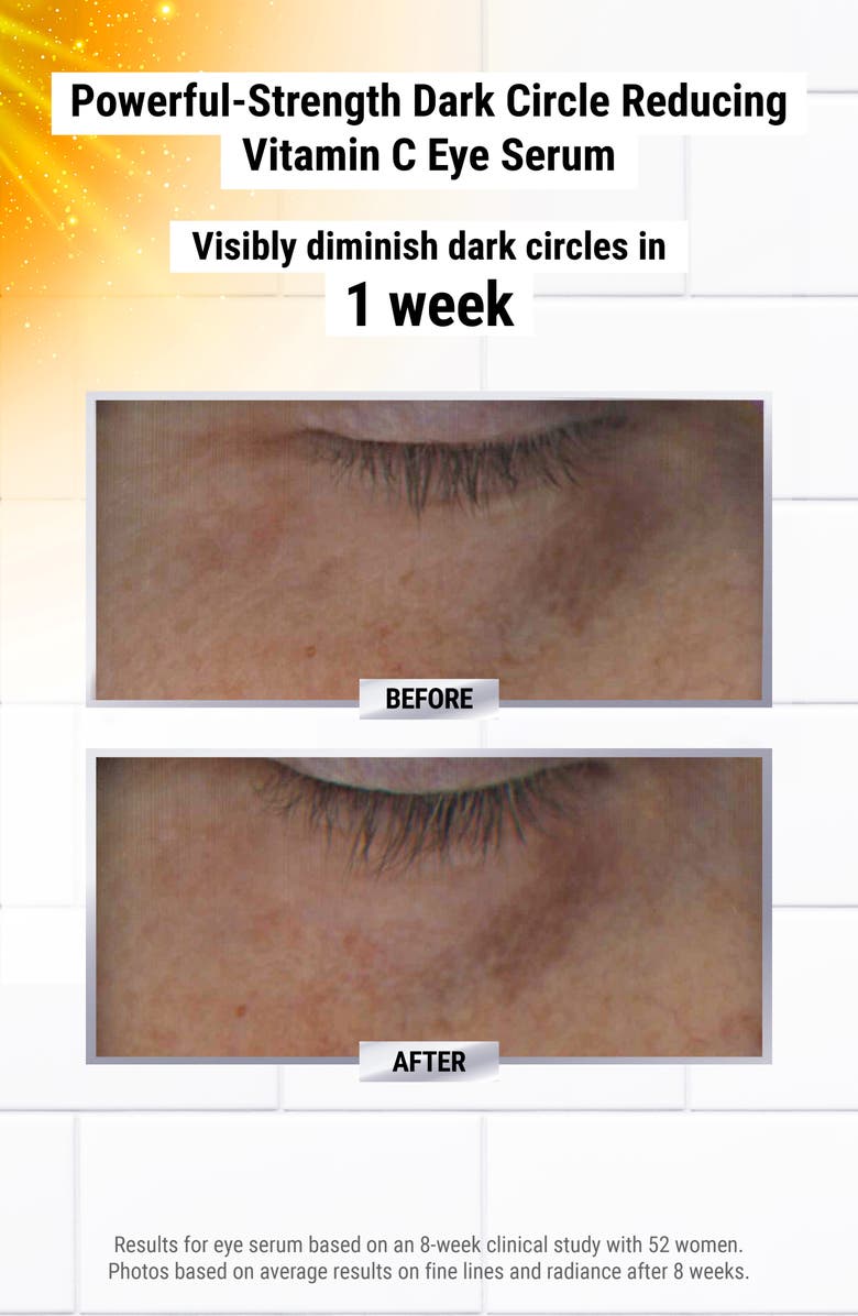 Kiehl's Since 1851 Day-to-Night Line-Reducing Set USD $151 Value, Alternate, color,