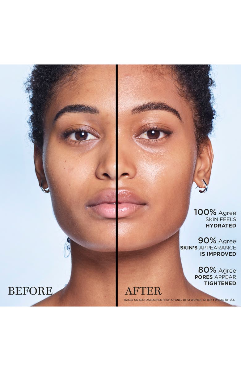 Lancôme Clarifique Refining & Brightening Dual Essence Exfoliating Treatment, Alternate, color,