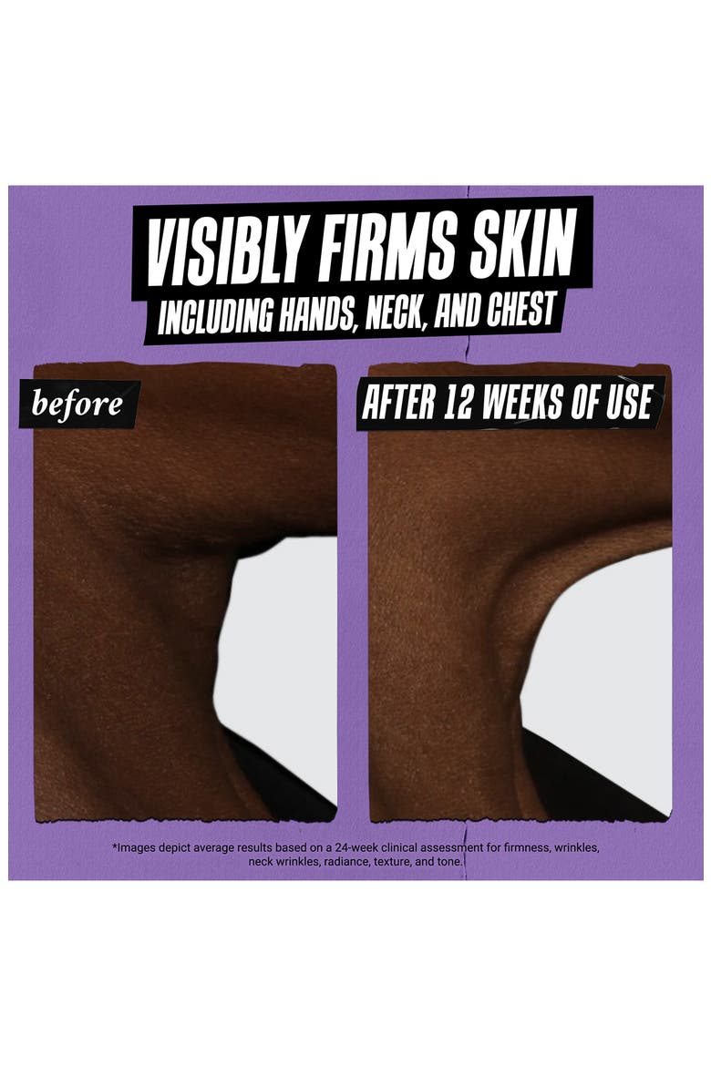 Retinol Skin-Renewing Daily Micro-Dose Facial Serum, Alternate, color, NO COLOR