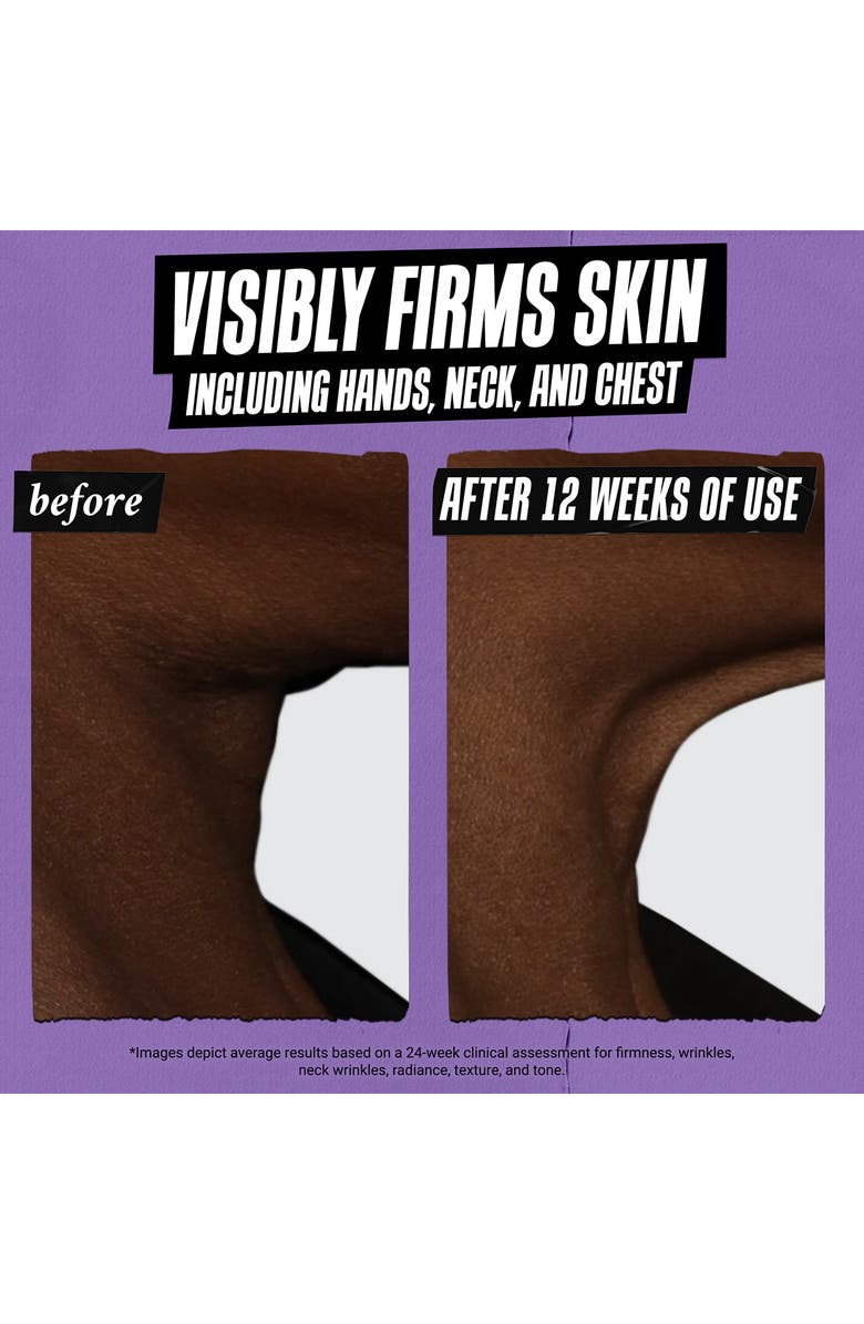 Kiehl's Since 1851 Retinol Skin-Renewing Daily Micro-Dose Facial Serum, Alternate, color, 