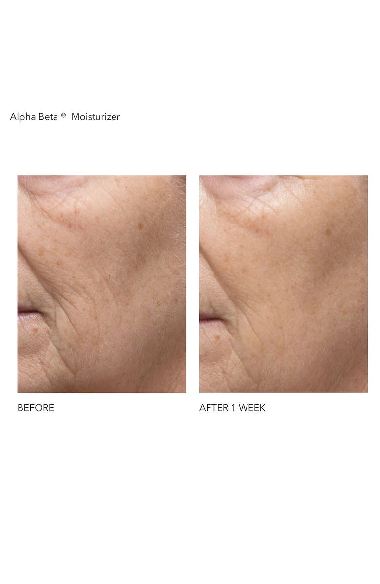 Dr. Dennis Gross Skincare Alpha Beta<sup>®</sup> Daily Moisturizer, Alternate, color,