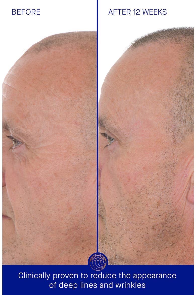The Retinol Serum, Alternate, color, NO COLOR