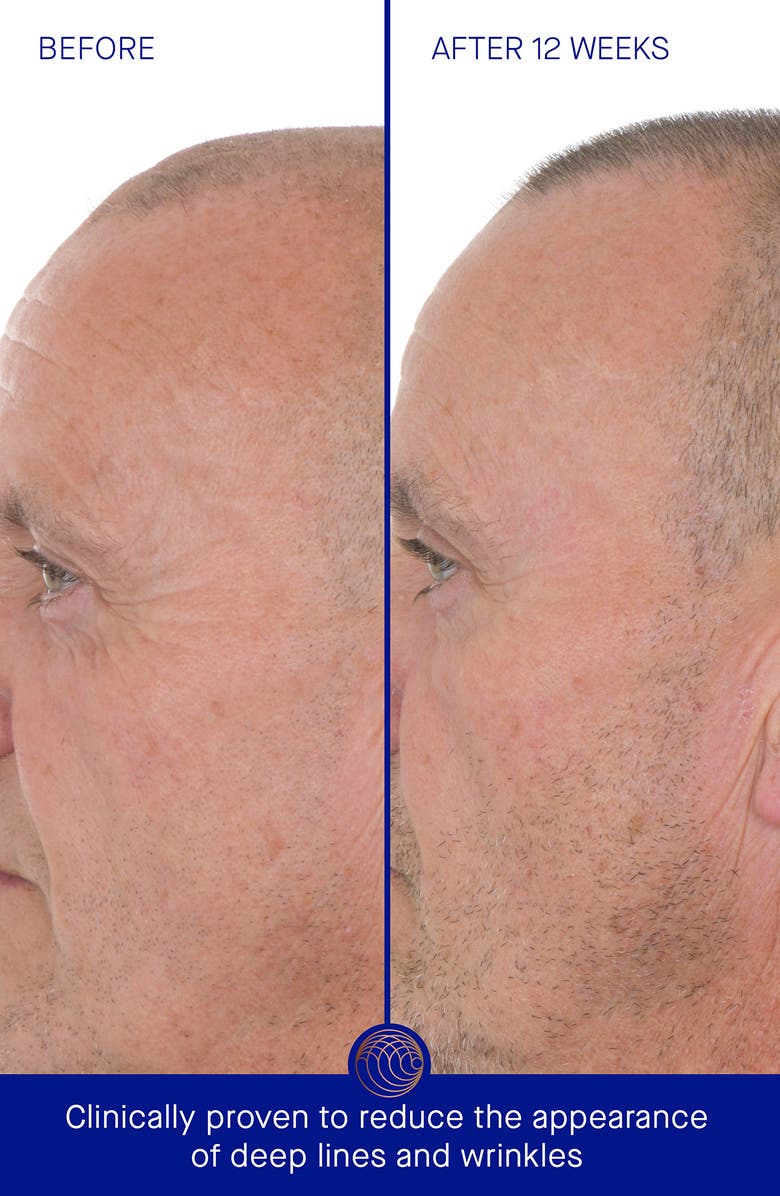 Augustinus Bader The Retinol Serum, Alternate, color, 