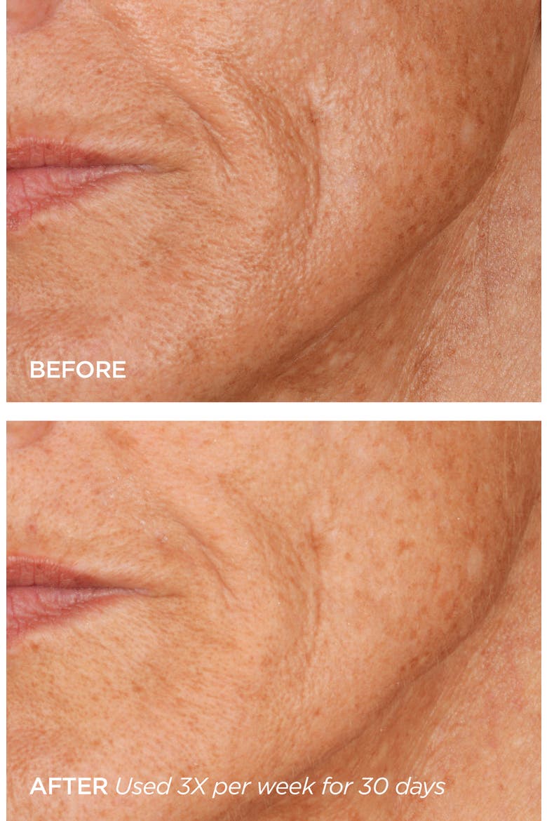 GloPRO® Microneedling Regeneration Head-to-Toe Glo Set (Nordstrom Exclusive), Alternate, color, NO COLOR