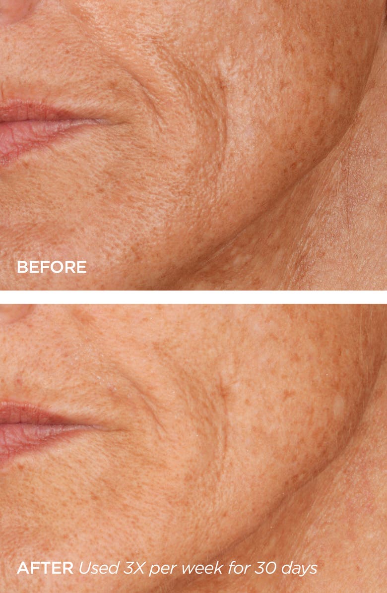 BeautyBio GloPRO<sup>®</sup> Microneedling Regeneration Head-to-Toe Glo Set, Alternate, color,