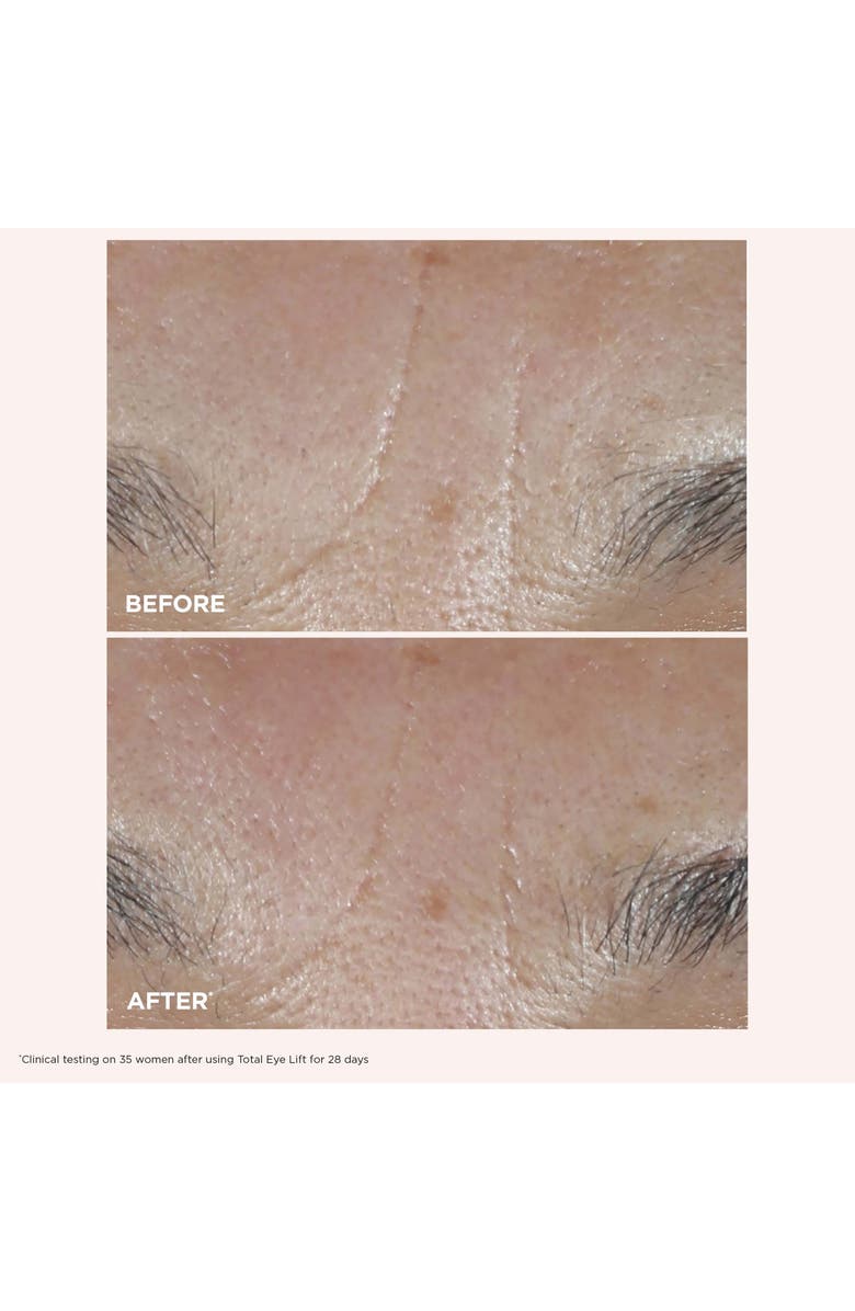 Clarins Face & Eyes Anti-Aging Set $190 Value, Alternate, color,