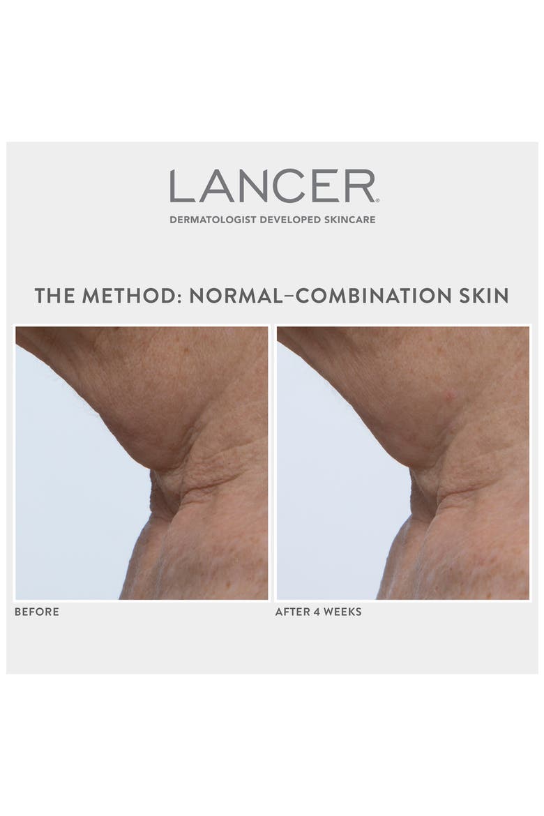 Lancer Method Set $270 Value, Alternate, color, NO COLOR