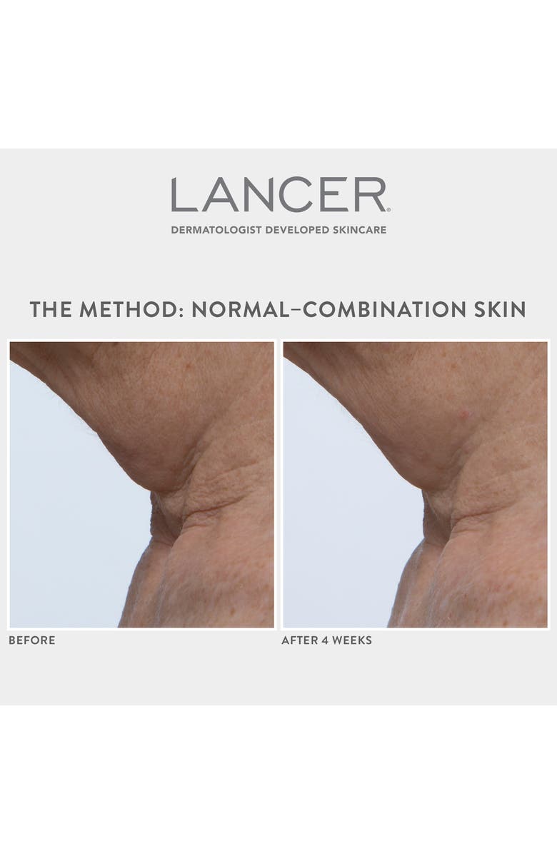LANCER Skincare Lancer Method Set $270 Value, Alternate, color,