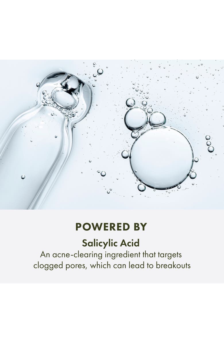 Origins Super Spot Remover<sup>™</sup> Acne Treatment Gel, Alternate, color, 