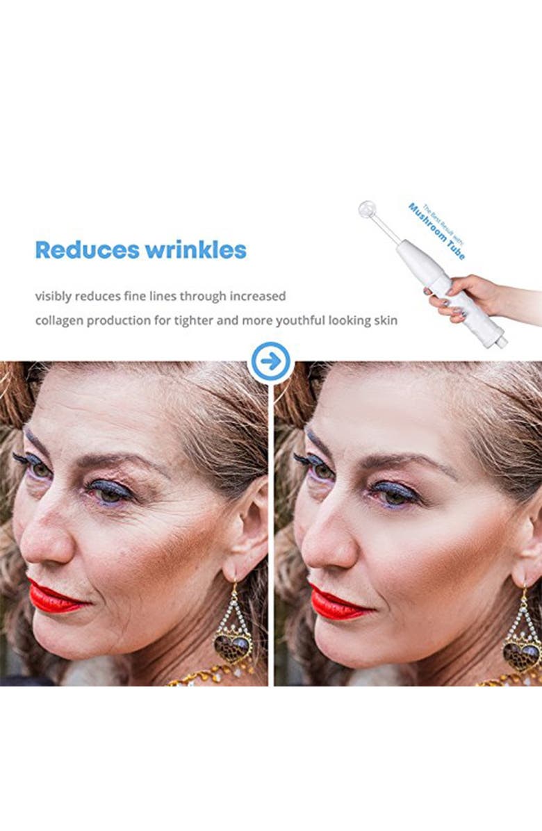 PURE DAILY CARE NuDerma Portable Handheld High Frequency Skin Therapy Wand Machine, Alternate, color, 