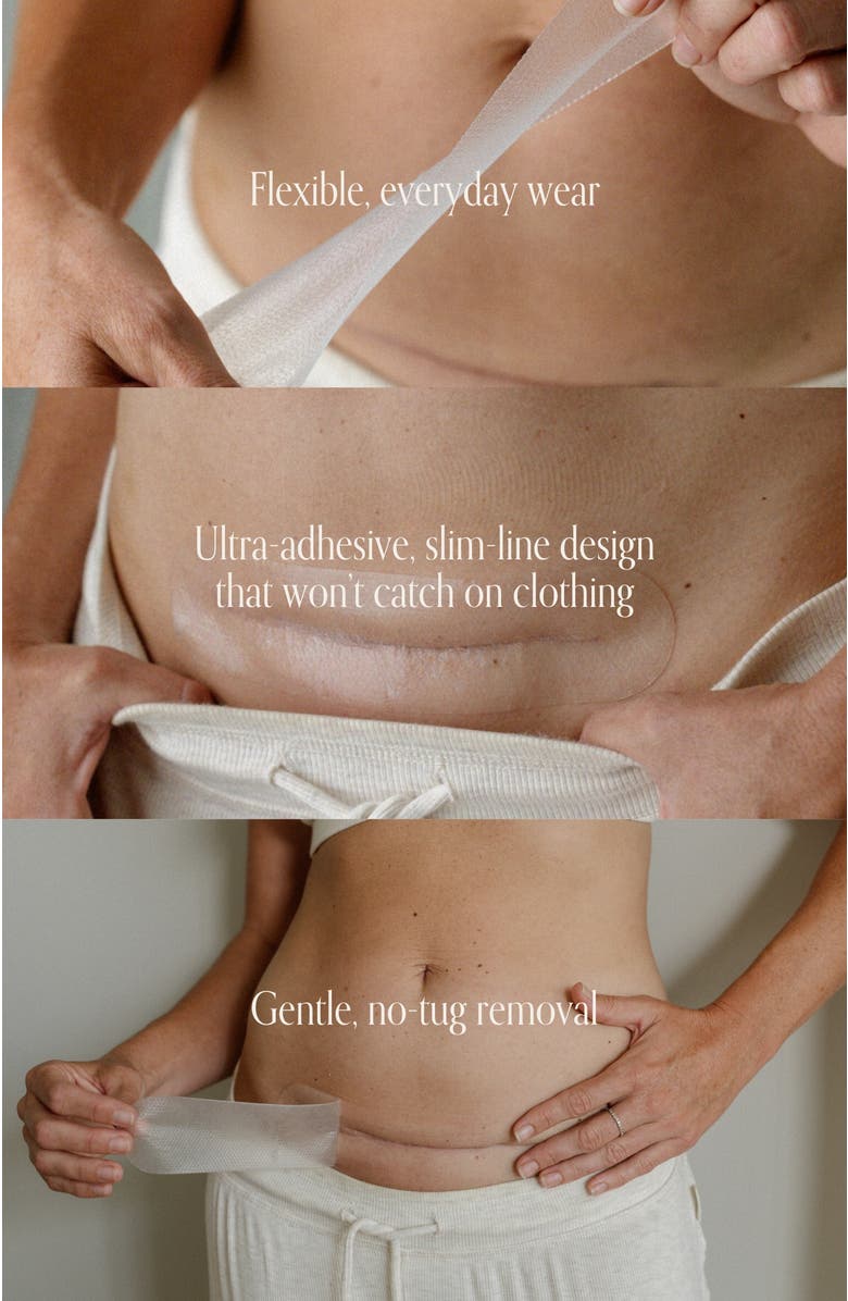 PURE MAMA Silicone Scar Strip, Alternate, color, Clear