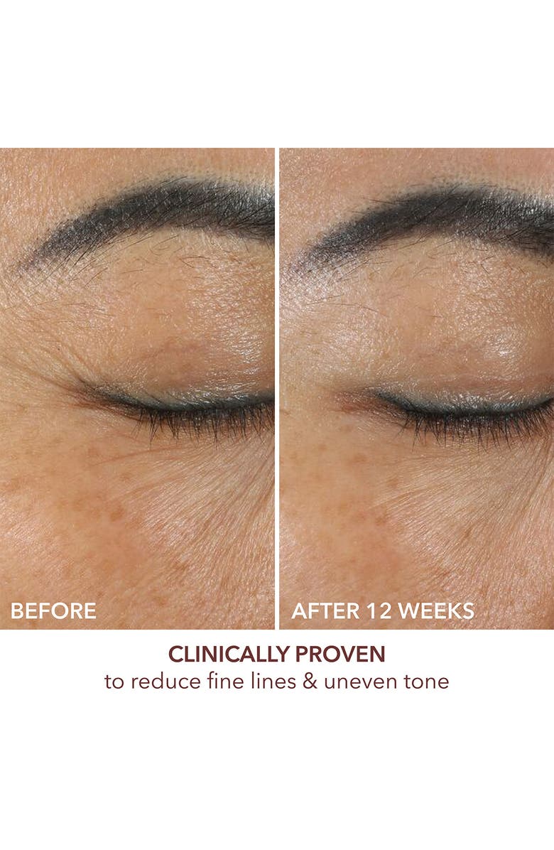 Dr. Dennis Gross Skincare Advanced Retinol + Ferulic Overnight Wrinkle Treatment, Alternate, color,