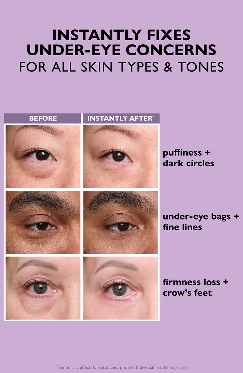 Peter Thomas Roth Instant FIRMx<sup>®</sup> Eye Temporary Eye Tightener, Alternate, color,