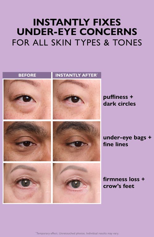 Peter Thomas Roth Instant Firmx Eye Temporary Eye Tightener Easy-wear Formula For Firming Under-eye Bags & Wrinkles 0. In Transparent