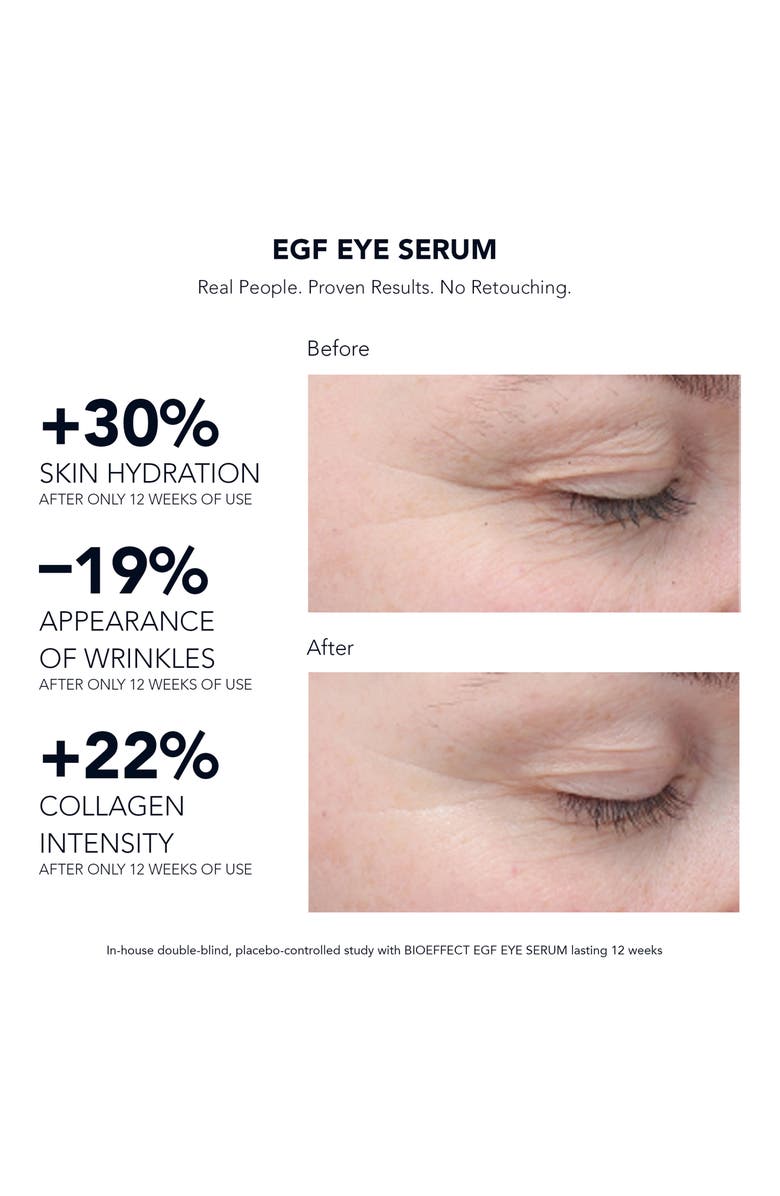 BIOEFFECT EGF Eye Serum, Alternate, color, 