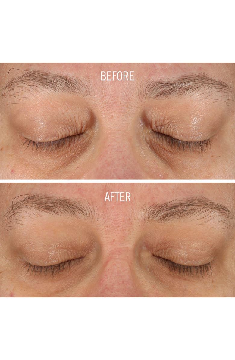 First Aid Beauty Fab Skin Lab Retinol Eye Cream, Alternate, color,