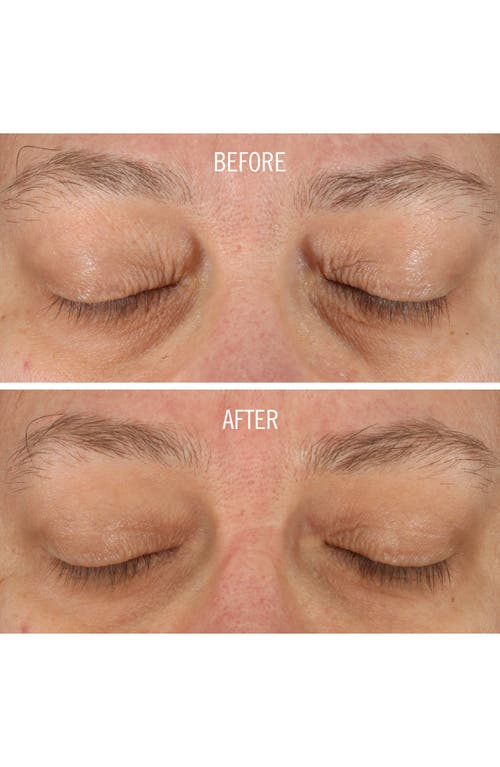 First Aid Beauty Fab Skin Lab Retinol Eye Cream