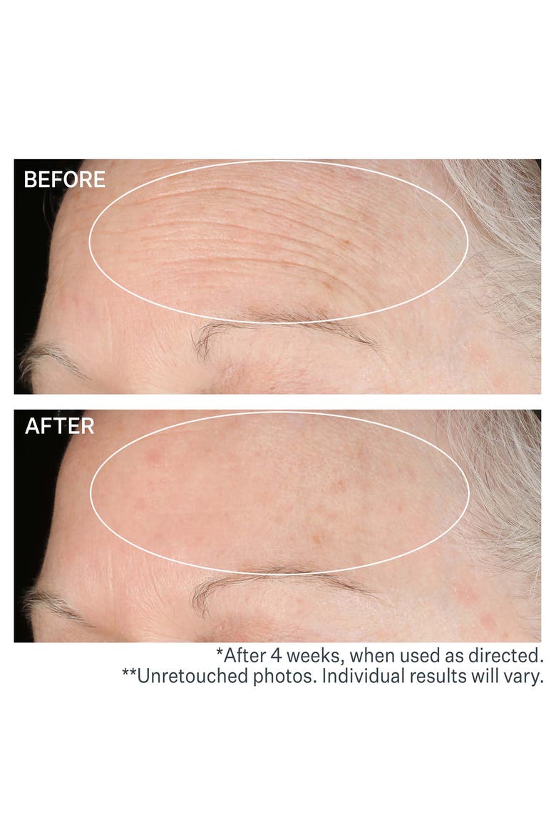 SD™ Advanced Intensive Moisturizing Concentrate for Wrinkles & Stretch Marks, Alternate, color, NO COLOR
