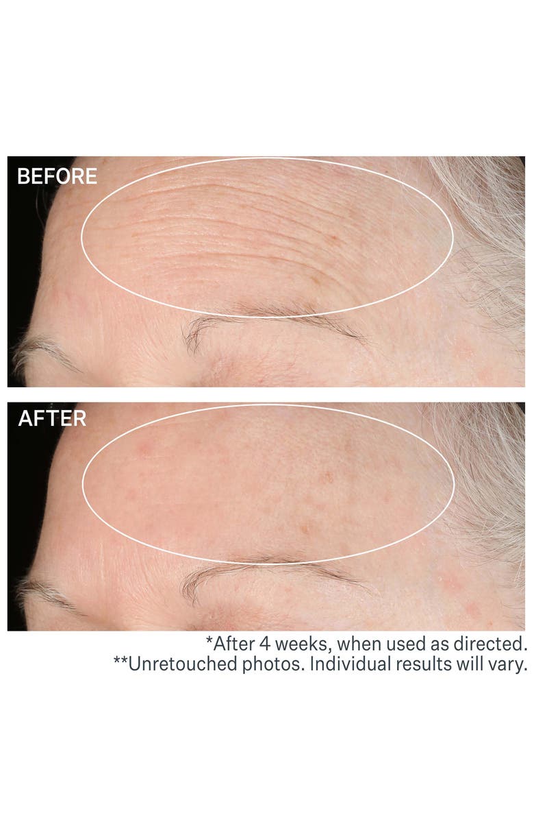 StriVectin<sup>®</sup> SD<sup>™</sup> Advanced Intensive Moisturizing Concentrate for Wrinkles & Stretch Marks, Alternate, color,