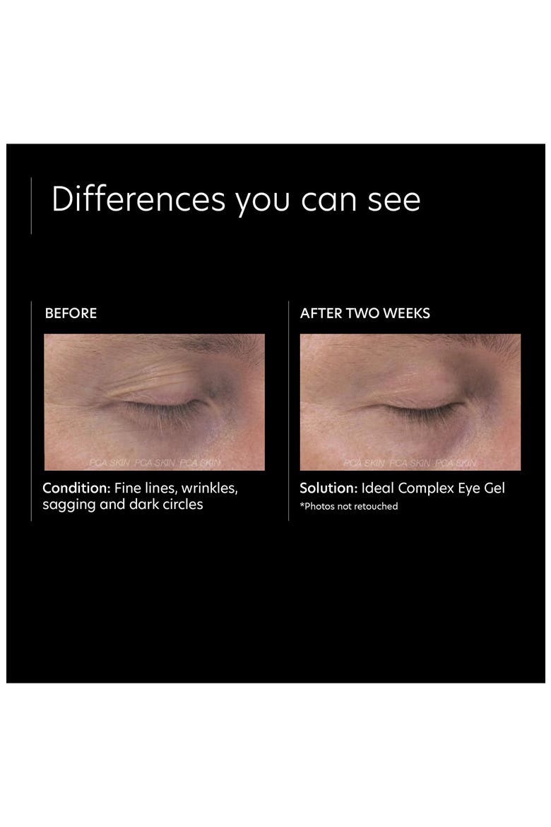 Ideal Complex Revitalizing Eye Gel, Alternate, color, NO COLOR