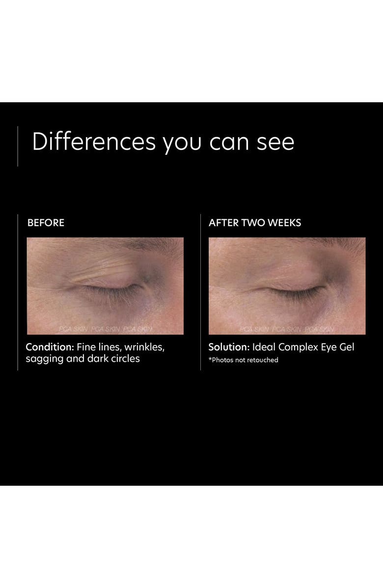 PCA Skin Ideal Complex Revitalizing Eye Gel, Alternate, color, 