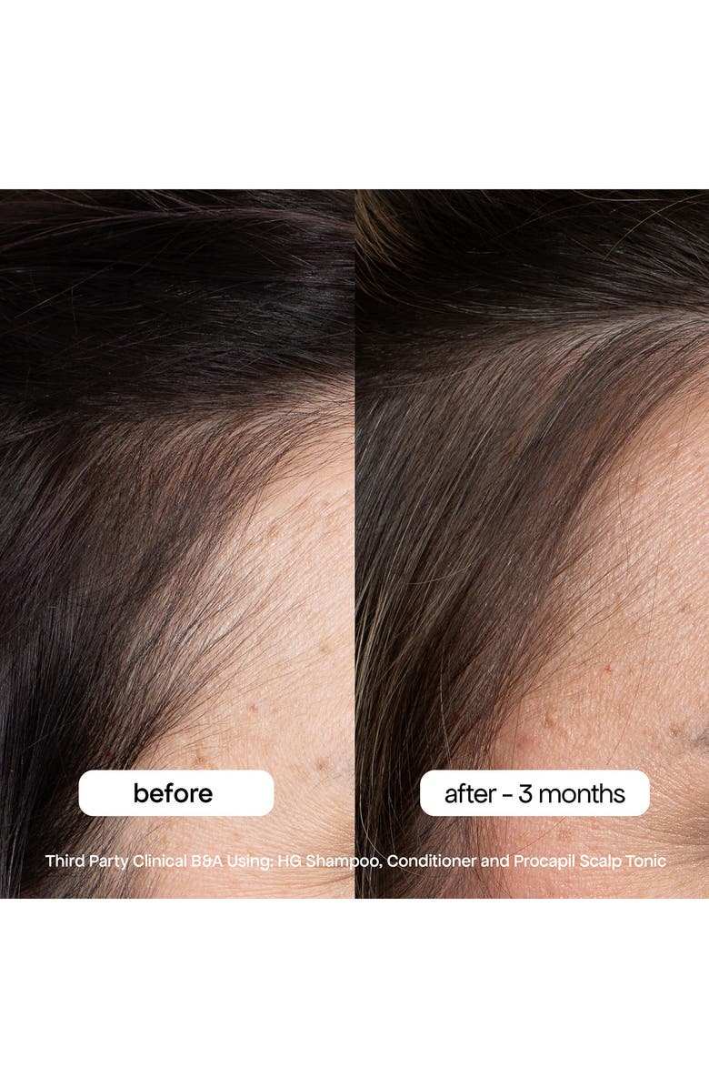 BONDI BOOST HG Shampoo, Alternate, color,