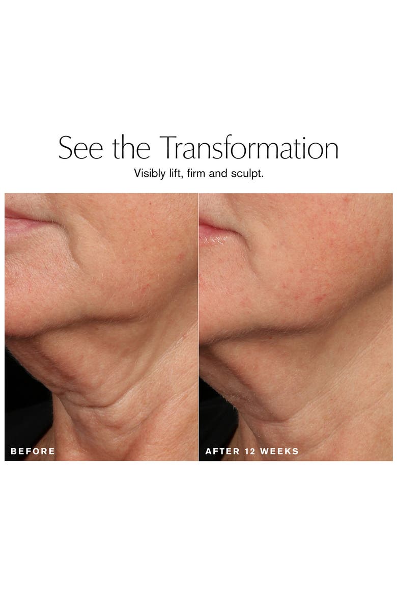 Revitalizing Supreme+ Sculpting Serum, Alternate, color, NO COLOR