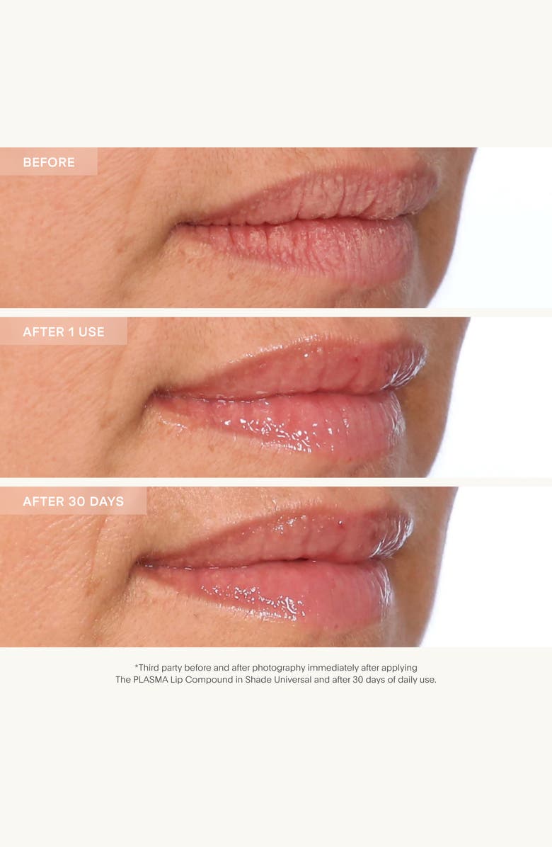 U Beauty The PLASMA Lip Compound, Alternate, color, 