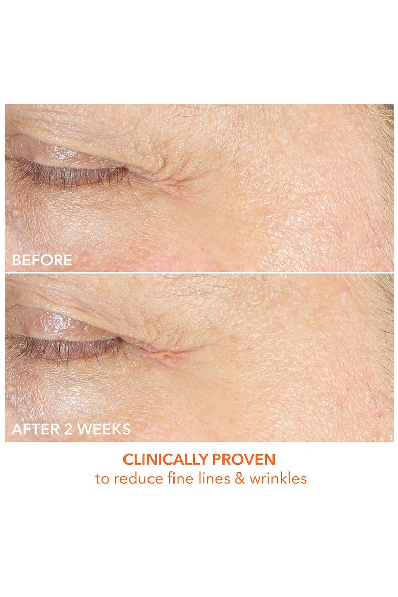 Vitamin C Lactic Firm & Bright Eye Treatment, Alternate, color, NO COLOR