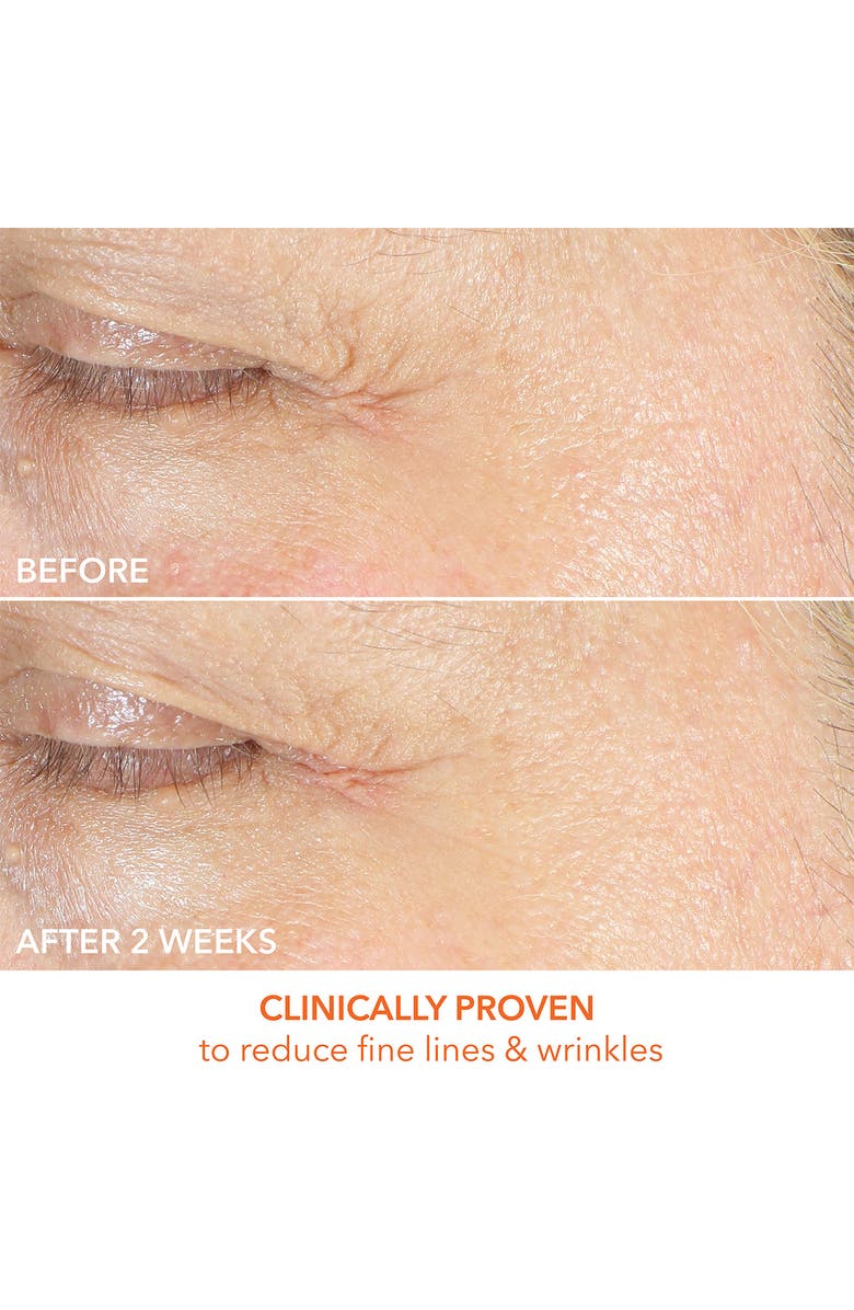 Dr. Dennis Gross Skincare Vitamin C Lactic Firm & Bright Eye Treatment, Alternate, color, 