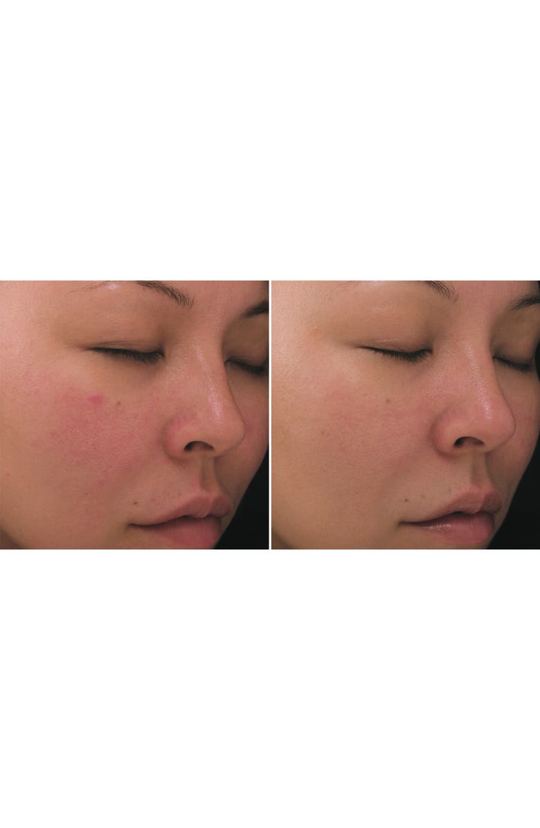 PCA Skin Retinol Treatment for Sensitive Skin, Alternate, color,