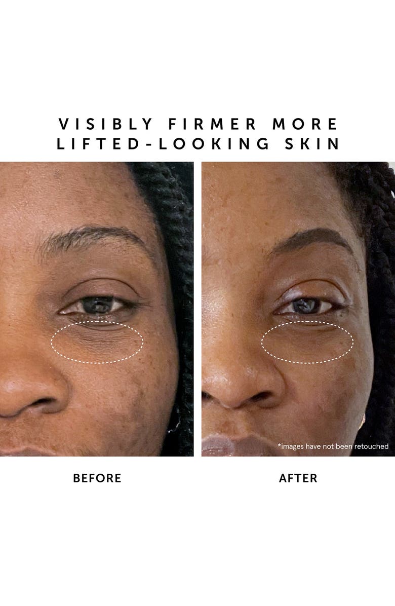 Herbivore Botanicals Moon Dew 1% Bakuchiol + Peptides Retinol Alternative Firming Eye Serum, Alternate, color,