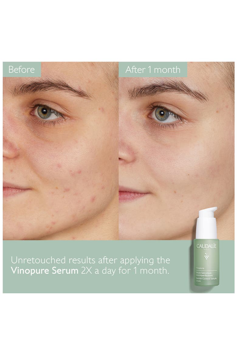 Vinopure Skin Perfecting Serum, Alternate, color, NO COLOR