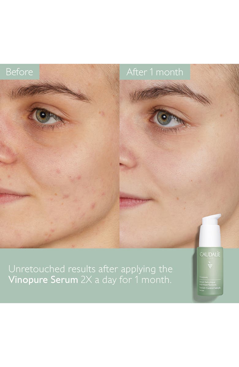 CAUDALÍE Vinopure Skin Perfecting Serum, Alternate, color,