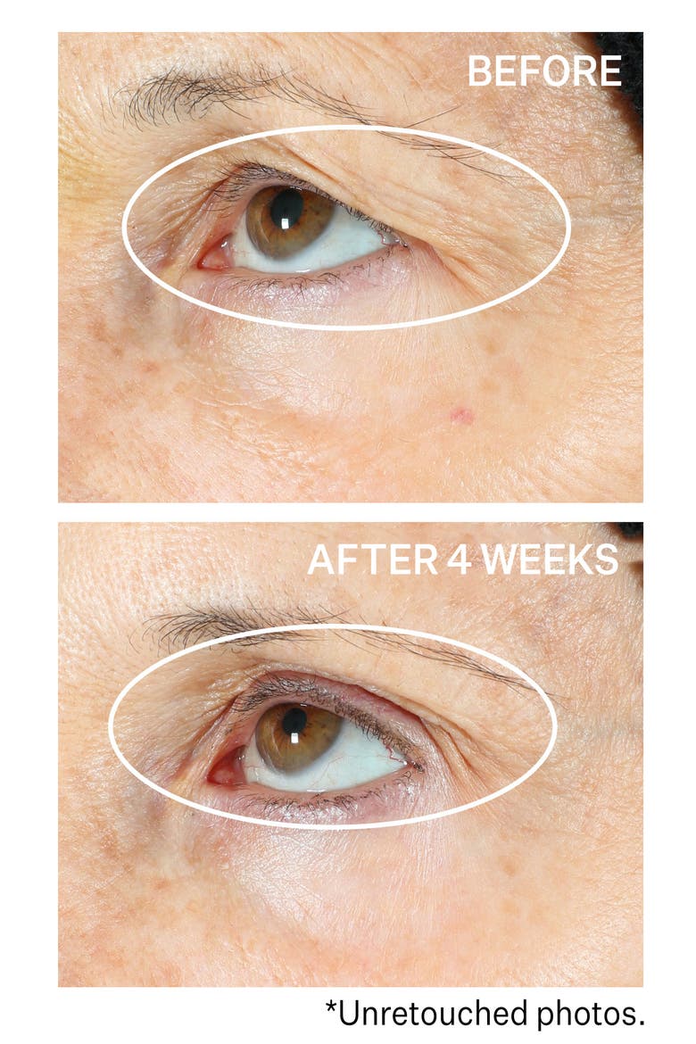 360° Tightening Eye Serum, Alternate, color, NO COLOR