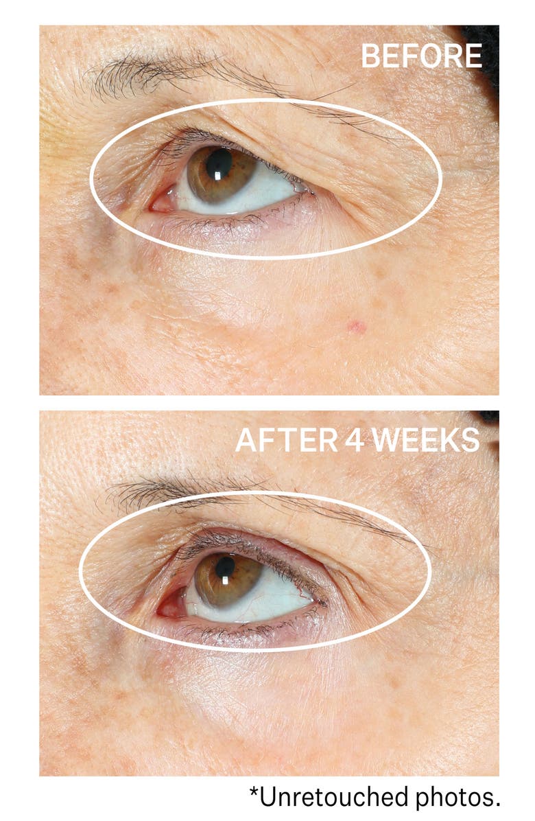 StriVectin<sup>®</sup> 360° Tightening Eye Serum, Alternate, color,