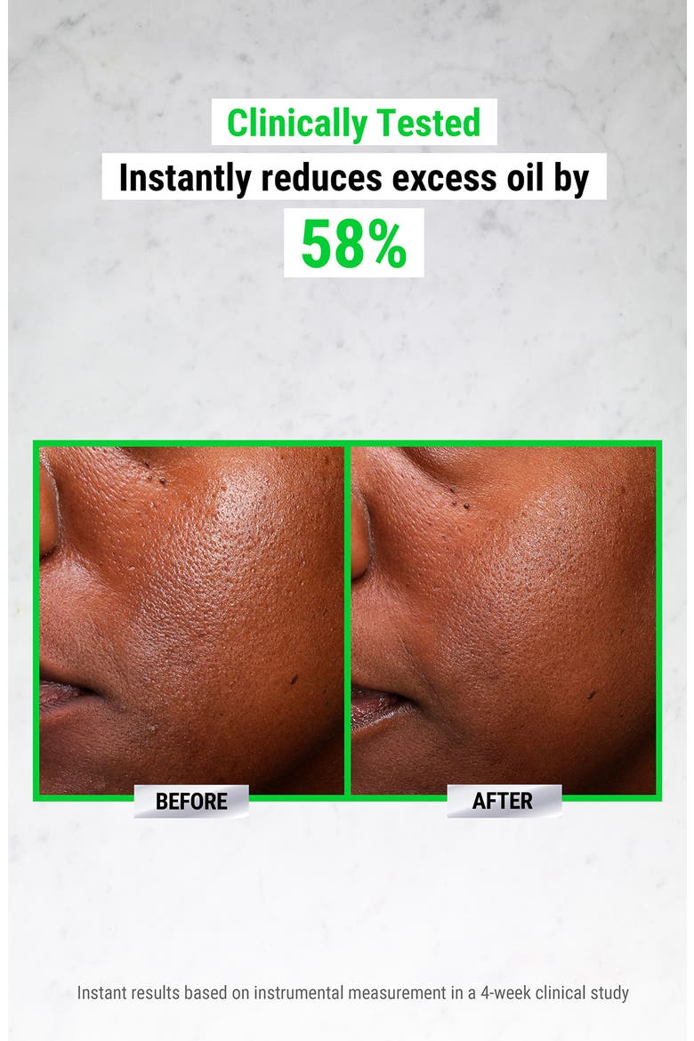Ultra Pure High-Potency Serum 5.0% Niacinamide, Alternate, color, NO COLOR
