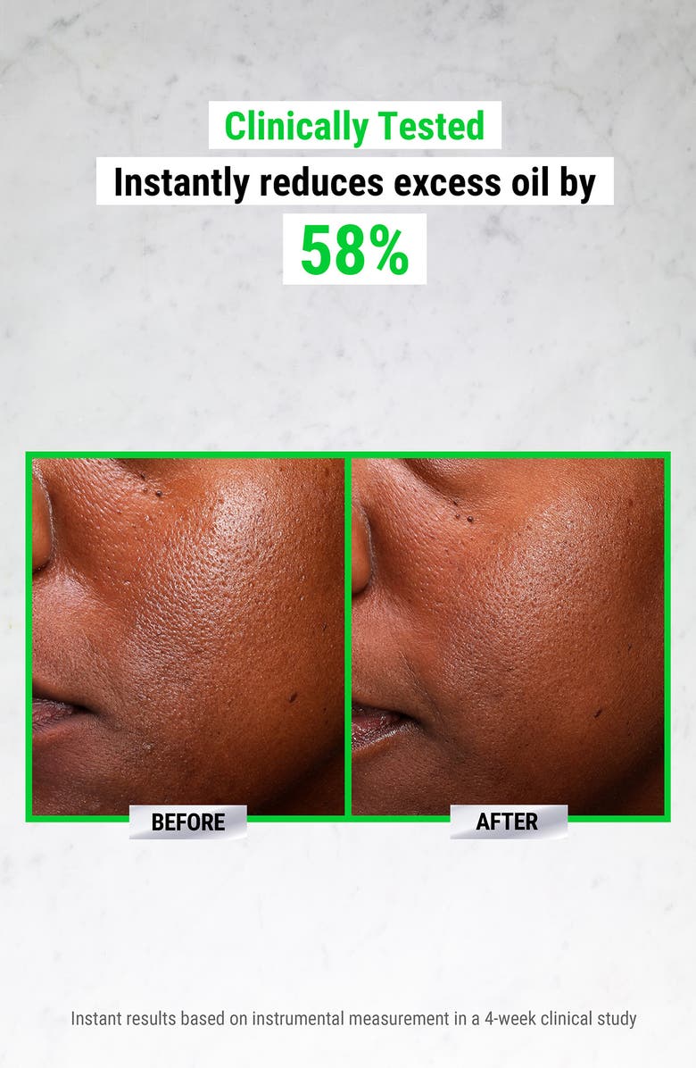 Kiehl's Since 1851 Ultra Pure High-Potency Serum 5.0% Niacinamide, Alternate, color, 