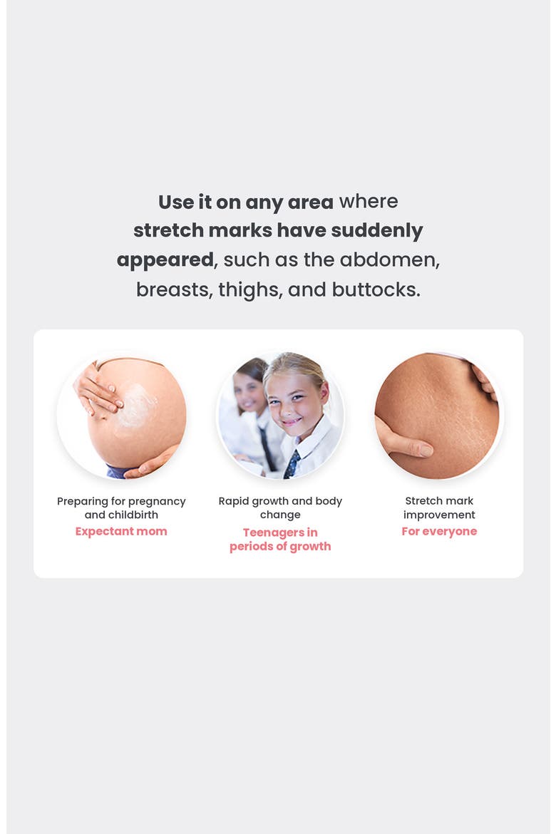 Maternity Care Stretch Mark Cream, Alternate, color, NO COLOR