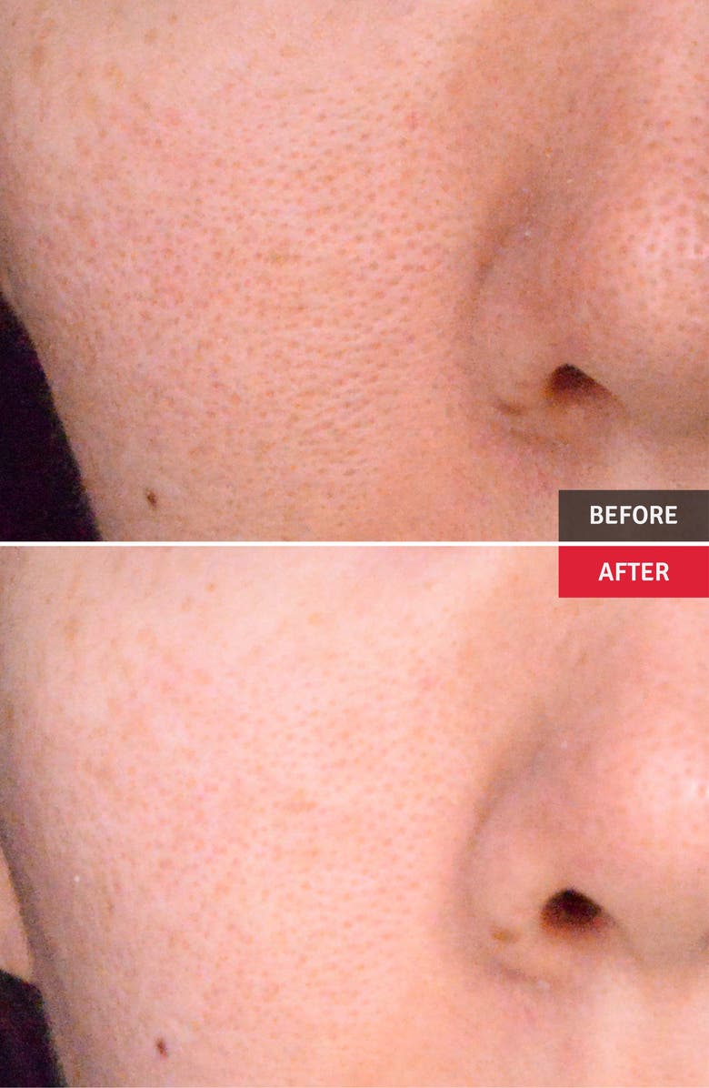 Vitabrid C12 Wrinkle Serum Professional Set, Alternate, color,