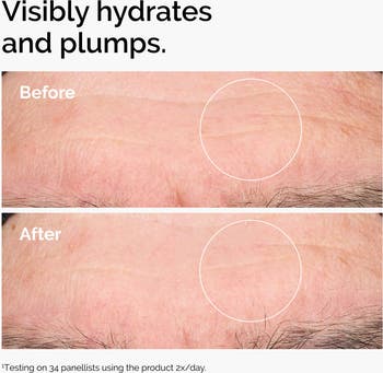 Hyaluronic Acid 2% + B5
