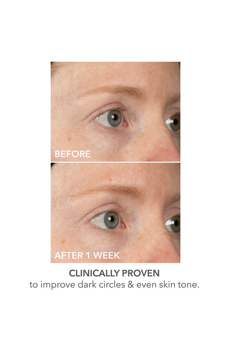 Dr. Dennis Gross Skincare DermInfusions Lift + Repair Eye Mask, Alternate, color, 