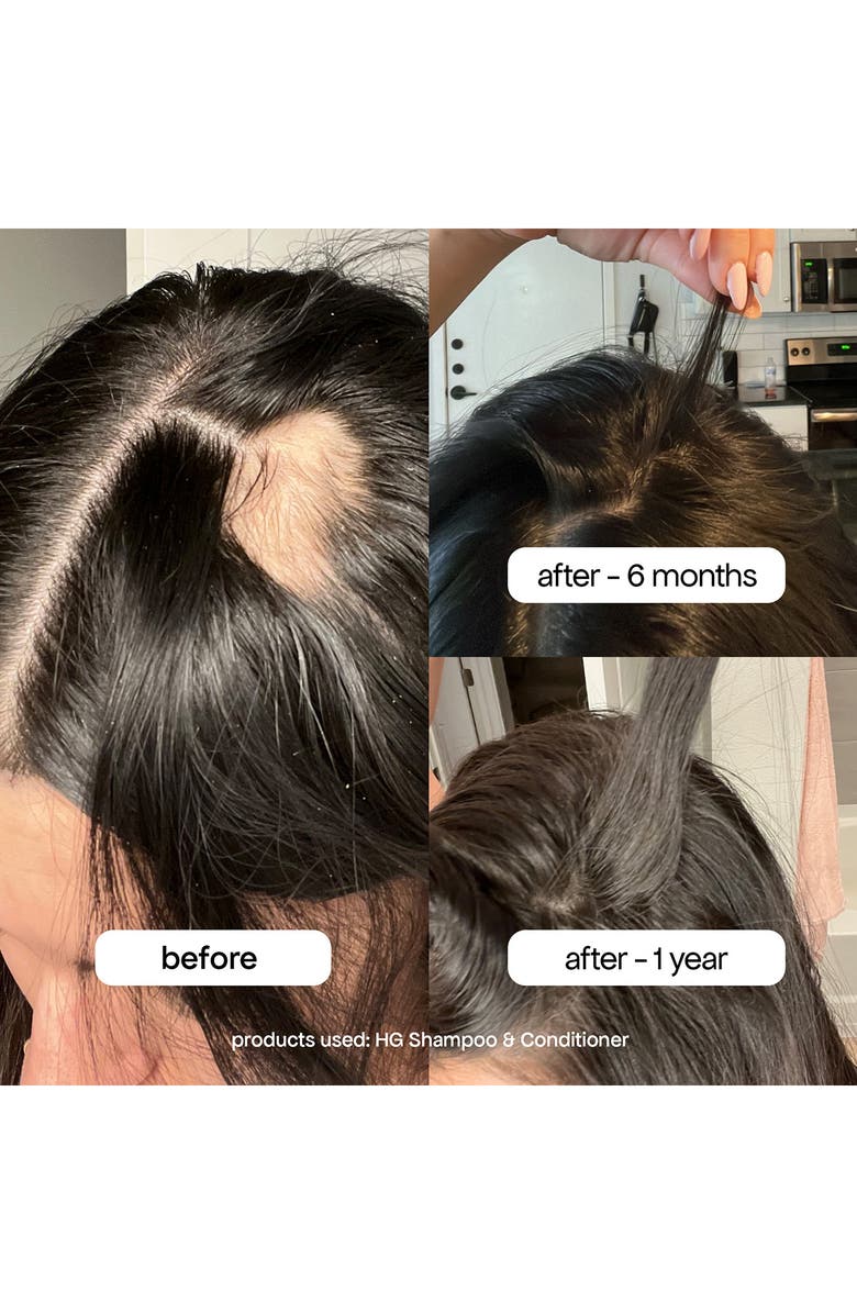 BONDI BOOST HG Shampoo, Alternate, color,