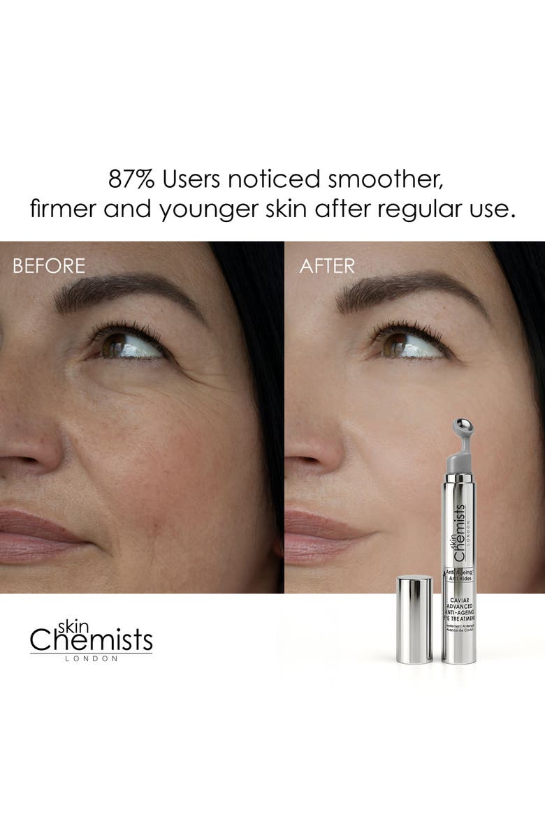 SKINCHEMISTS Caviar Advanced Anti-Ageing Eye Treatment 15ml, Alternate, color, 