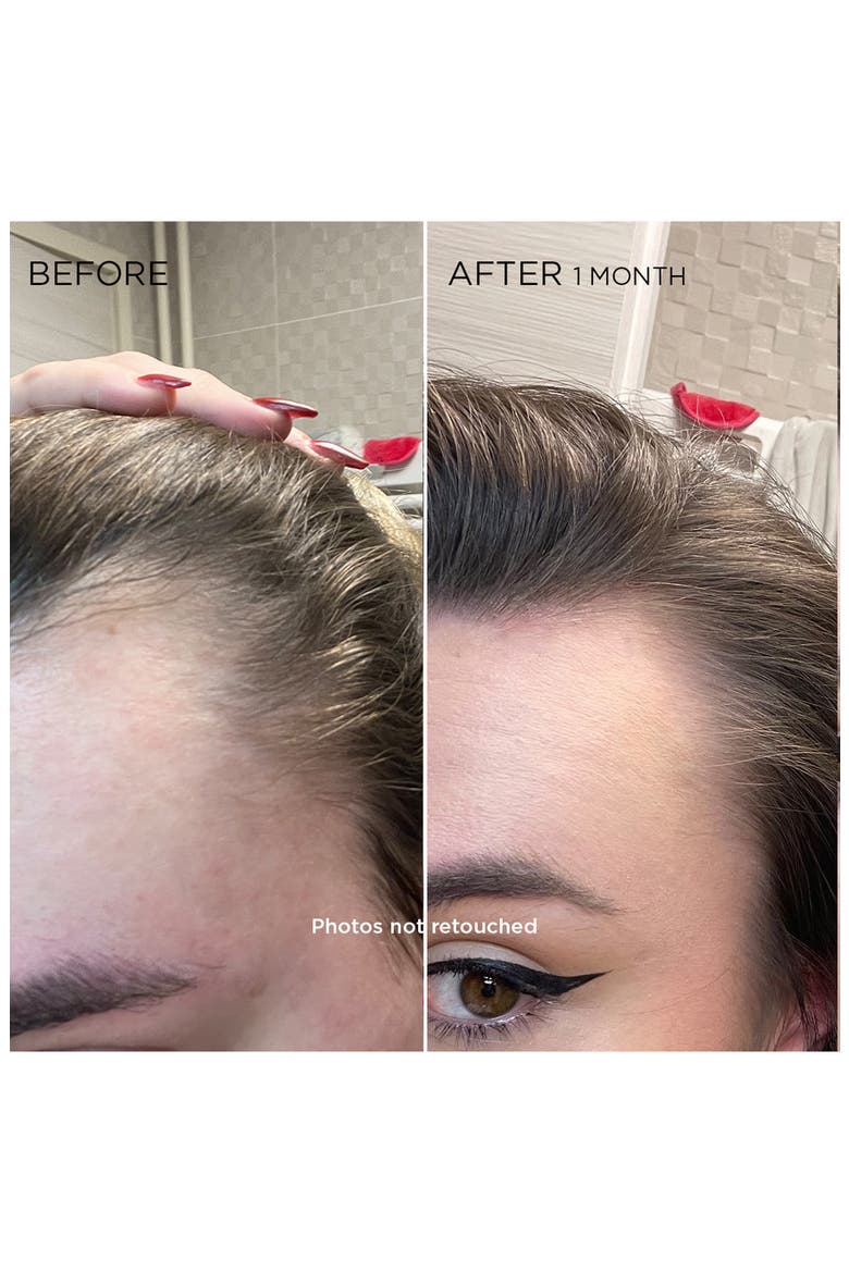 PHYTOCYANE Revitalizing Scalp Serum For Temporary Hair Thinning, Alternate, color, NO COLOR