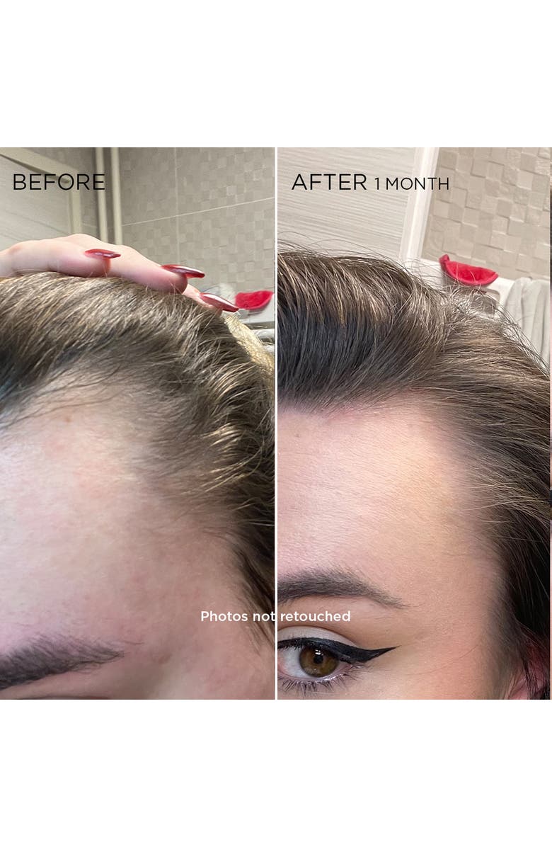 PHYTO CYANE Revitalizing Scalp Serum For Temporary Hair Thinning, Alternate, color,