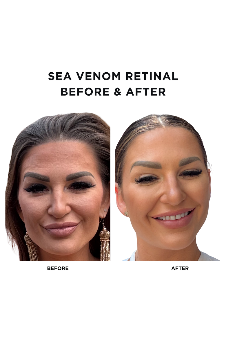Sea Venom Retinal | 1fl.oz/30ml | Anti-Aging Time Released Retinaldehyde | Regenerating Sensamone P5 | Restructuring, Alternate, color, None