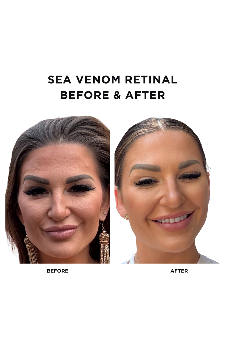 Intoxicated Cosmetics Sea Venom Retinal | 1fl.oz/30ml | Anti-Aging Time Released Retinaldehyde | Regenerating Sensamone P5 | Restructuring, Alternate, color, NO COLOR