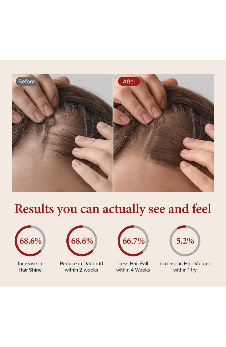 KUNDAL Caffeine Scalp Care Shampoo - White Musk, Alternate, color, Brown