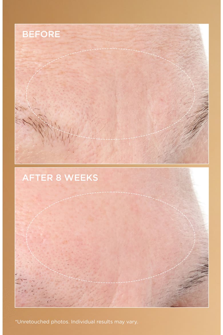 Neuropeptide Deep Crease Serum, Alternate, color, NO COLOR
